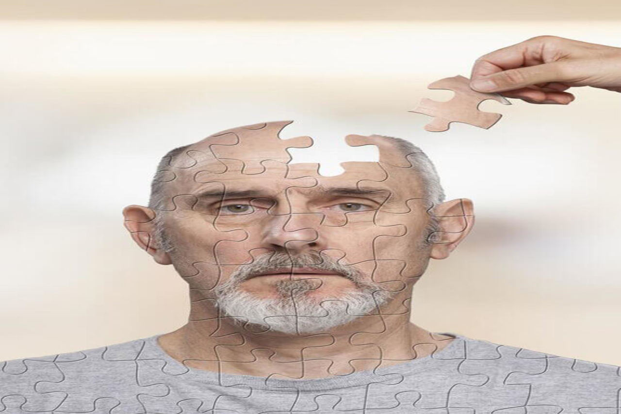 شناسایی ۳۲ پروتئین که ریسک ابتلا به آلزایمر را نشان می دهد